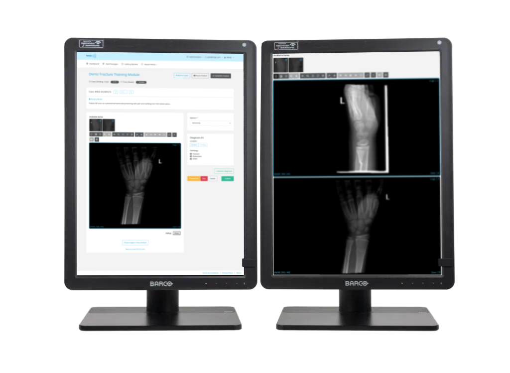 Reporting workstation showing wrist x-rays