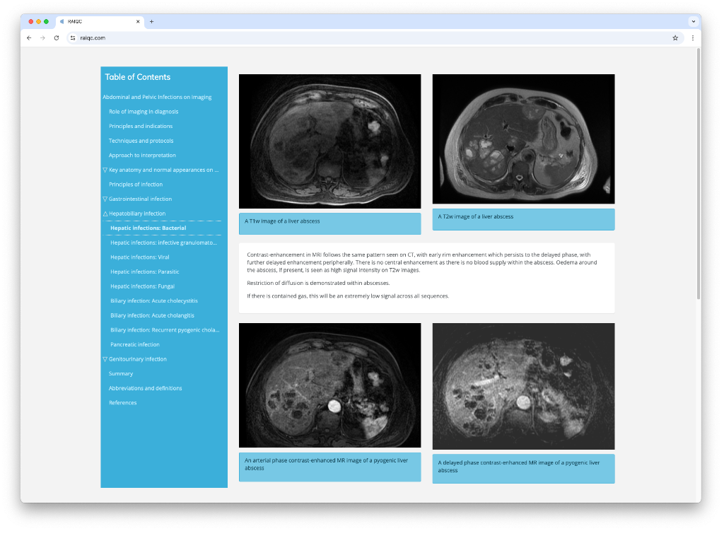 Example educational material showing copy and images next to table of contents